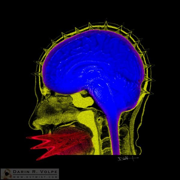 "One-Way Conversation" by Darin Volpe [Digital Art From an MRI Scan of a Human Head]